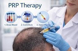 PRP Therapy Etobicoke