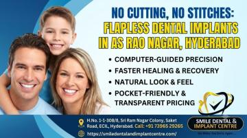 Minimally Invasive Flapless Dental Implants in AS Rao Nagar | No Cutting, No Stitches
