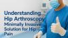 Understanding Hip Arthroscopy – Minimally Invasive Solution for Hip Pain