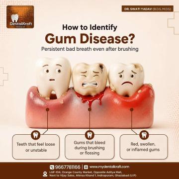 Searching for the Best Dental Clinic in Indirapuram for Your Dental Care?