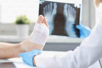 Book Arthritis Test Package in Gandhinagar - Nidan Path Lab
