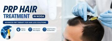 Best PRP Hair Treatment in Noida for Hair Regrowth