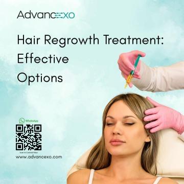 Hair Regrowth Treatment: Effective Options