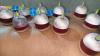 Cupping Therapy in Jaipur – Relieve Pain & Boost Healing Naturally