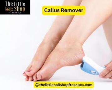 Premium Callus Remover for Smooth, Soft Feet