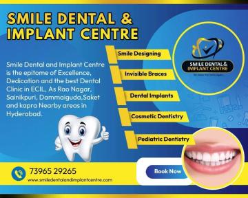 Top-Rated Dentist Near Sainikpuri & ECIL – Painless Family Dental Care