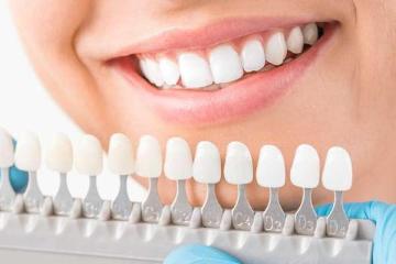 Miami Cosmetic Dentistry for Professional Teeth Whitening