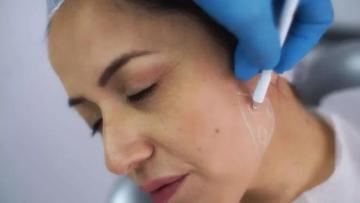 Jawline Fillers Explained: Benefits, Procedure, Results & Aftercare Guide