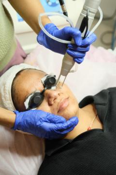 Exosome Therapy for Hair Growth in Hyderabad – Koniki Luxe