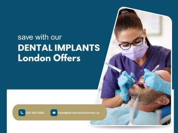 Grab offers and deals on tooth implants solution