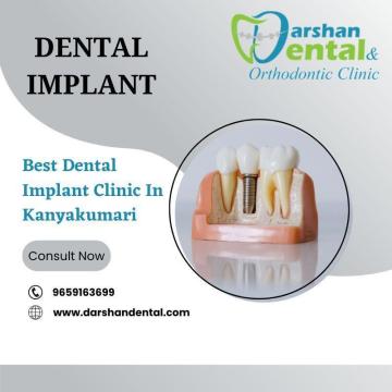 Dental implant clinic in kanyakumari | Best Dental Clinic In Kanyakumari