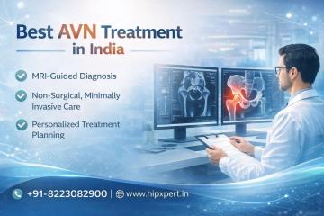 Best AVN Treatment in India - HipXpert