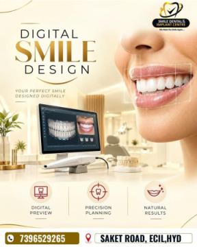 Digital Smile Design | Your Perfect Smile, Designed Digitally