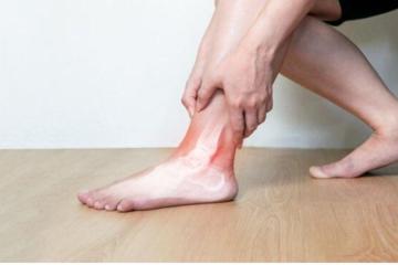 Advanced Heel Bone Pain Treatment by CuraFoot Specialists