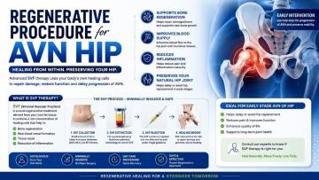 Regenerative Procedure for AVN Hip Treatment – SVF Therapy