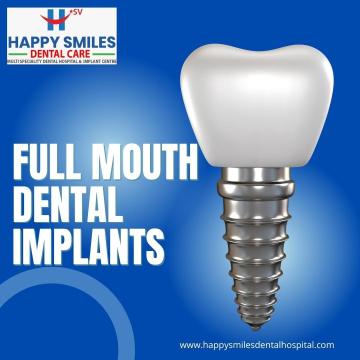 Advanced Dental Implants Treatment — Vanasthalipuram Clinic