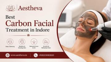 Best Carbon Facial Treatment in Indore