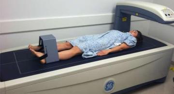 Bone Density Test Etobicoke