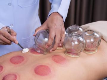 Cupping Therapy Greenville SC For Natural Relief & Wellness Care