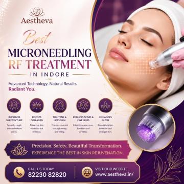Best Microneedling RF Treatment in Indore - Aestheva