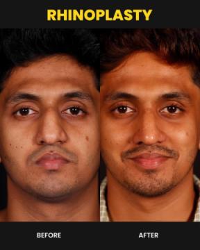 Cosmetic Surgeon in Kochi