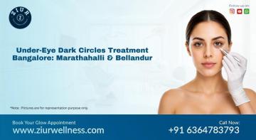 Under Eye Dark Circles Treatment in Marathahalli Bangalore