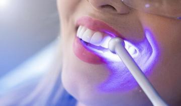 Teeth Whitening Surrey BC