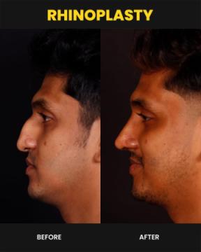 Cosmetic Surgeon in Kochi