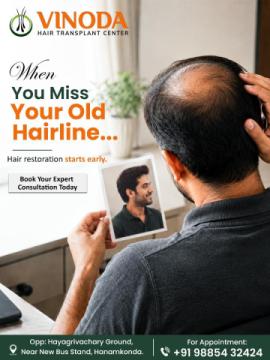 Best Hair Transplant Surgeon in Hanamkonda