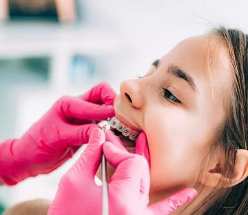 ⚽ World Cup 2026 Smile Deal: Save on Quality Dental Care in Ventura