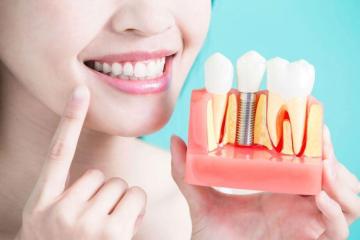 Dental cleaning Fort Worth