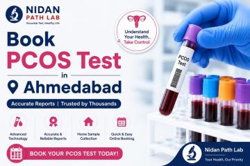 Book PCOS Test in Gandhinagar at Nidan Path Lab