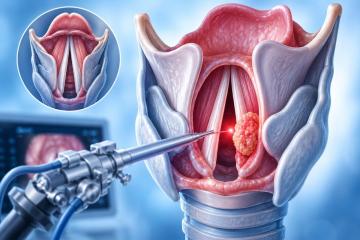 Voice Preserving Surgery for Throat Cancer in Delhi NCR | Modern Treatment Options