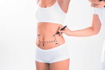 Advanced Care for Liposuction Fibrosis – Aspen After Surgery Center